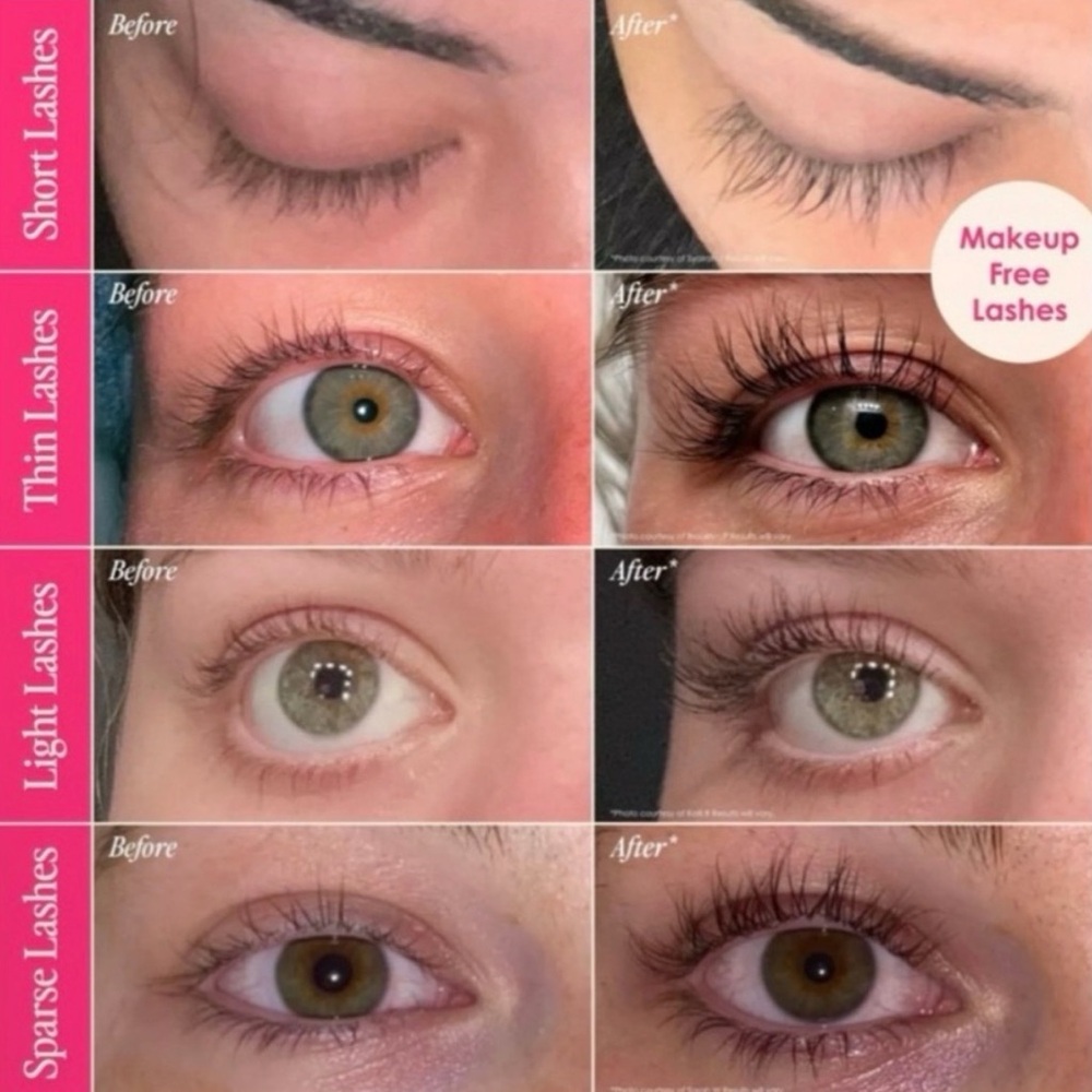GrandeLASH-MD Lash Enhancing Serum – 3 mo Supply - Picture 7 of 9